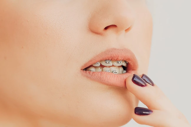 brackets